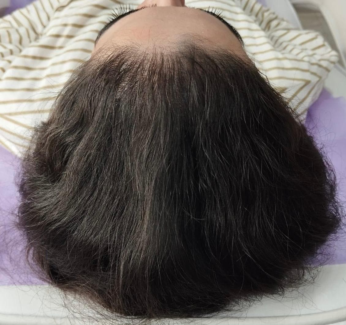 قبل - فراغات الشعر