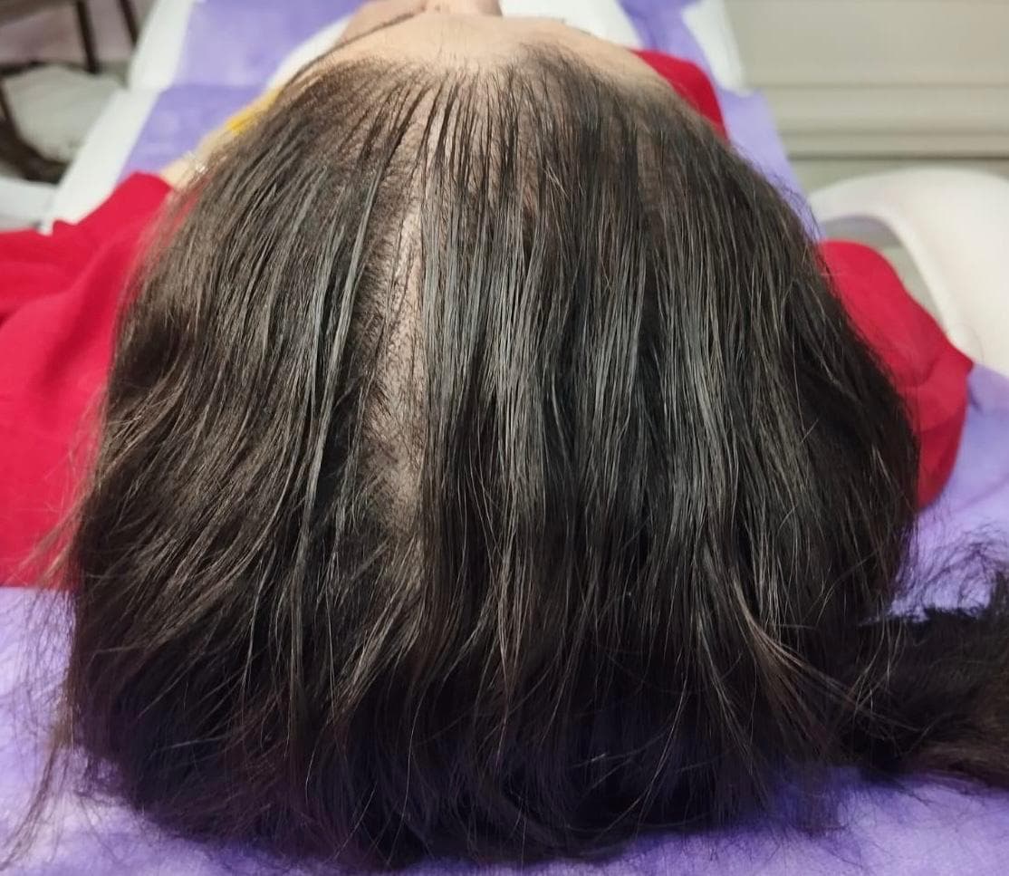 بعد - فراغات الشعر