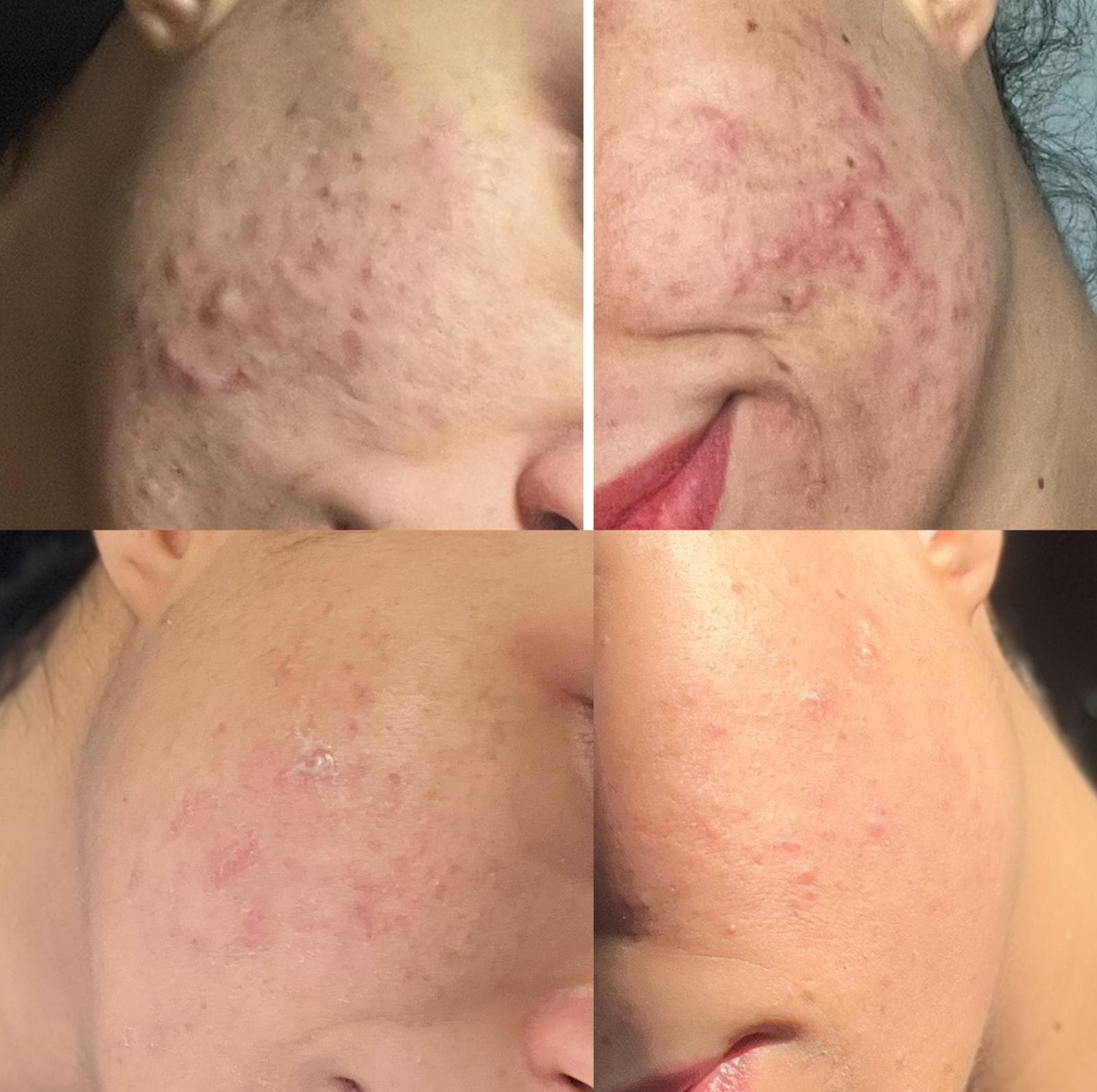 Multiple Cases — Before & After